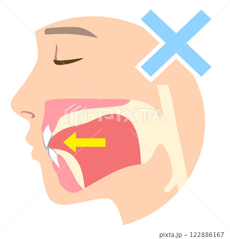 正しいミューイングの方法　適正な舌の位置と誤った舌の位置 122886167