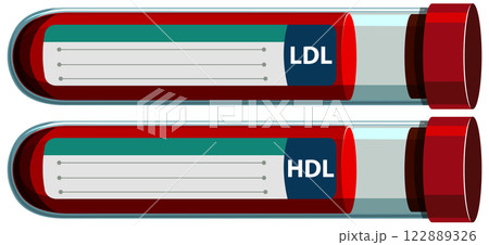 Cholesterol Blood Test Tubes Illustration Cholesterol Blood Test Tubes Illustration 122889326