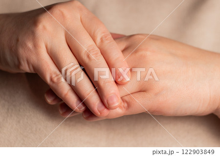 Closeup image of fingers and nails bitten. Health and medical concept. Manicure artist. Image for before and after. 122903849