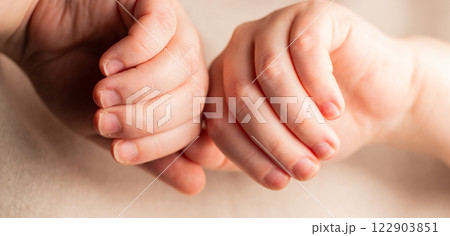 Woman showing her hands with bitten nails. Small nail plate. Poor manicure 122903851