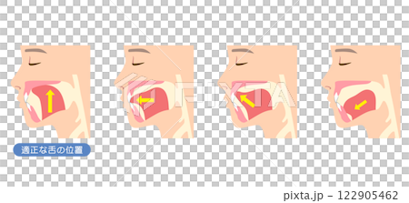 How to mew properly: correct and incorrect tongue position 122905462