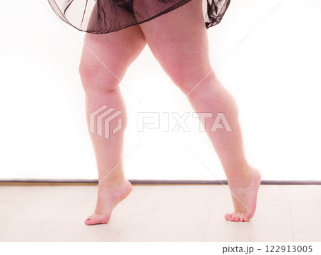 Fat woman legs only 122913005