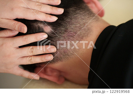 円形脱毛症の男性 122919568