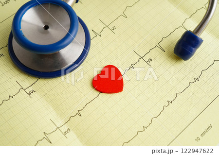 Stethoscope on electrocardiogram ECG, heart wave, heart attack, cardiogram report. Stethoscope on electrocardiogram ECG, heart wave, heart attack, cardiogram report. 122947622