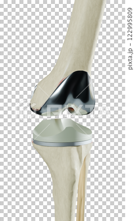 bone, anatomy, knee 122995809