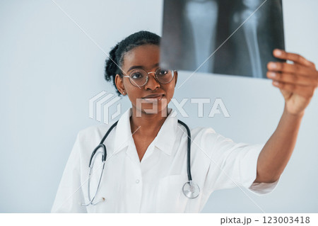 X-ray with picture of bones. Young african american woman is against white background 123003418
