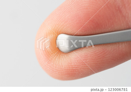 Close up of pinching blister 123006781