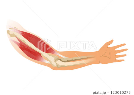 Arm muscle biceps with skeleton. Muscle tension of human hand on white background. Bones and joints in male silhouette. Medical vector illustration of hand for clinic or hospital Arm muscle biceps with skeleton. Muscle tension of human hand on white background. Bones and joints in male silhouette. Medical vector illustration of hand for clinic or hospital 123010273