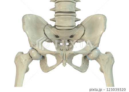 Subcapital femur fracture, 3D illustration 123039320