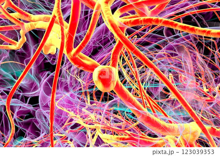 A close-up view of a saccular aneurysm on a brain artery, 3D illustration 123039353