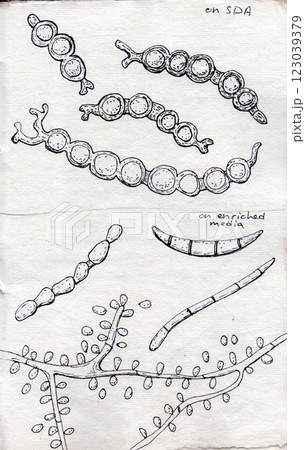 Hand-drawn pen illustration on aged paper depicting Trichophyton verrucosum morphology 123039379
