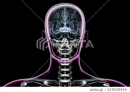 Atrophic substantia nigra in Parkinson's disease, 3D illustration 123039434