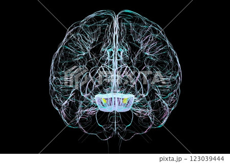 Atrophic substantia nigra in Parkinson's disease, 3D illustration 123039444