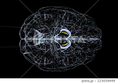 Atrophic substantia nigra in Parkinson's disease, 3D illustration 123039449