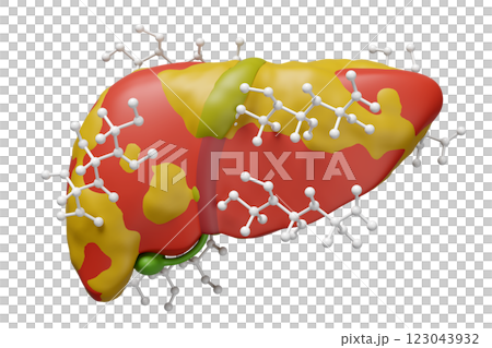 3d fatty liver disease with glucose molecule isolated. 3d illustration render 123043932