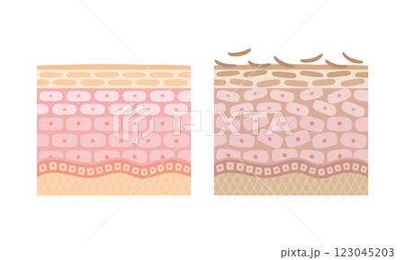 健康な肌と不健康な肌の比較イラスト 健康な肌と不健康な肌の比較イラスト 123045203