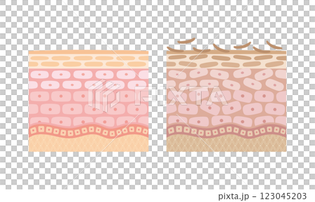 健康な肌と不健康な肌の比較イラスト 健康な肌と不健康な肌の比較イラスト 123045203