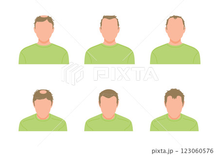 正面から見た薄毛の男性のシンプルなアイコンセット 123060576