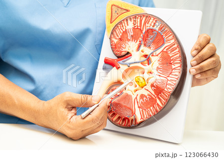 Kidney disease, Chronic kidney disease ckd, Doctor hold human model to treat and study in hospital. 123066430