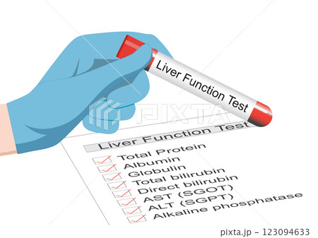 Liver function tests are blood tests. 123094633