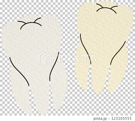 Teeth in different stages of color change development. Flat cartoon vector illustration isolated on background. Dental hygiene, whitening, and treatment concept. Teeth in different stages of color change development. Flat cartoon vector illustration isolated on background. Dental hygiene, whitening, and treatment concept. 123103555