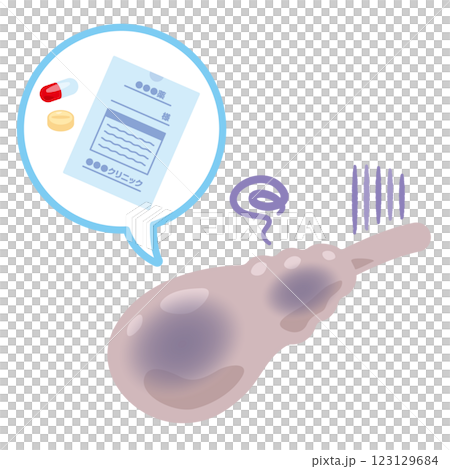薬剤と調子が悪い胆嚢のイラスト 123129684