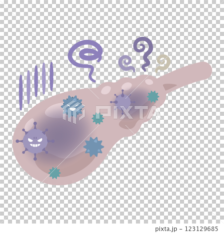 ウイルスに感染した胆嚢のイラスト 123129685
