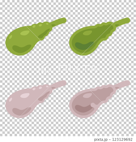Illustration of a healthy and clean gallbladder and an unhealthy gallbladder Illustration of a healthy and clean gallbladder and an unhealthy gallbladder 123129692
