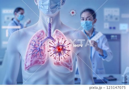 This is a detailed medical illustration depicting the lungs and the impact of viral infections 123147075