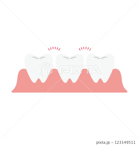 すきっ歯のイラスト すきっ歯のイラスト 123149511