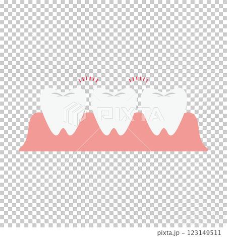 すきっ歯のイラスト すきっ歯のイラスト 123149511