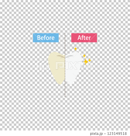 牙齒美白前後對比圖 牙齒美白前後對比圖 123149518