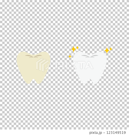 Before and after illustration of whitened teeth Before and after illustration of whitened teeth 123149519