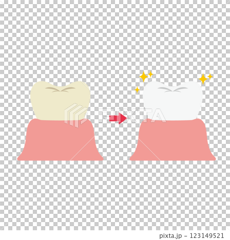 牙齒美白前後對比圖 123149521