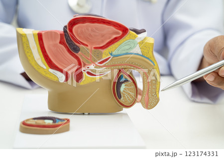 Male reproductive system, Asian doctor holding human anatomy model for study diagnosis and treatment in hospital. 123174331