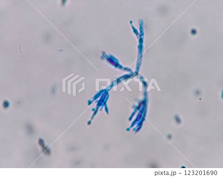 花のように広がるアオカビの分生子 123201690