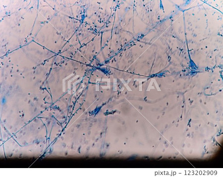 菌糸の間に見える分生子 123202909