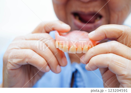 Asian senior woman patient holding teeth denture in her hand for chew food. Asian senior woman patient holding teeth denture in her hand for chew food. 123204591