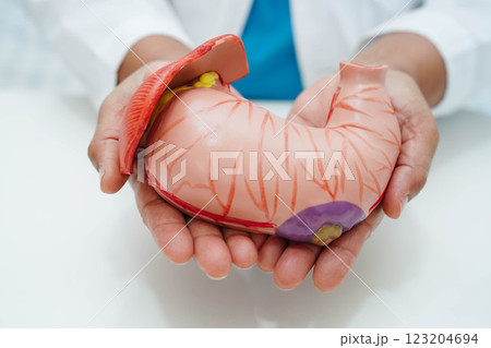Stomach disease, doctor holding anatomy model for study diagnosis and treatment in hospital. Stomach disease, doctor holding anatomy model for study diagnosis and treatment in hospital. 123204694