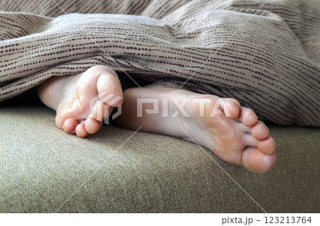 Dry cracked skin of woman feet in bed. Foot treatment. Dry cracked skin of woman feet in bed. Foot treatment. 123213764