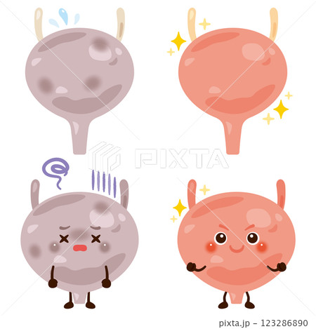 動きが鈍くなっている膀胱のキャラクターと元気な膀胱のキャラクター 123286890