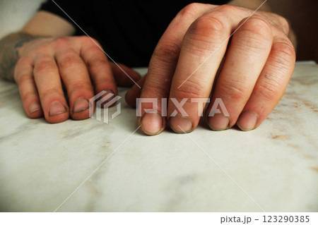 Male hands with broken nails close-up. Hand skin care Male hands with broken nails close-up. Hand skin care 123290385