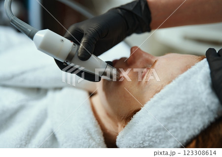 Skin treatment procedure at a wellness center for facial rejuvenation 123308614