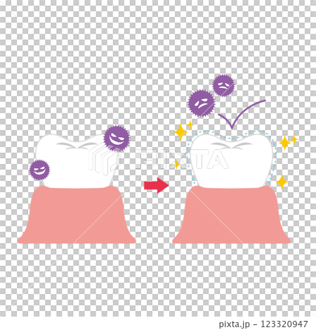 色素沈着や虫歯予防のコーティングをした歯のイラスト 123320947