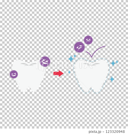 色素沈着や虫歯予防のコーティングをした歯のイラスト 色素沈着や虫歯予防のコーティングをした歯のイラスト 123320948