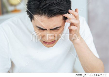 生え際とおでこニキビを気にする男性 123337436