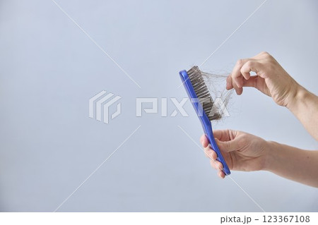 Comb and abundant hair loss on the background with copy space. The concept of hair loss. 123367108