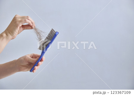 Comb and abundant hair loss on the background with copy space. The concept of hair loss. 123367109