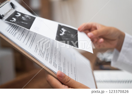 female therapist hands close up doctor scrutinizes patient ultrasound test results while working in a modern clinic.  123370826