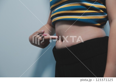 Women body fat belly. Obese woman hand holding excessive belly fat. diet lifestyle concept to reduce belly and shape up healthy stomach muscle. Women body fat belly. Obese woman hand holding excessive belly fat. diet lifestyle concept to reduce belly and shape up healthy stomach muscle. 123371125